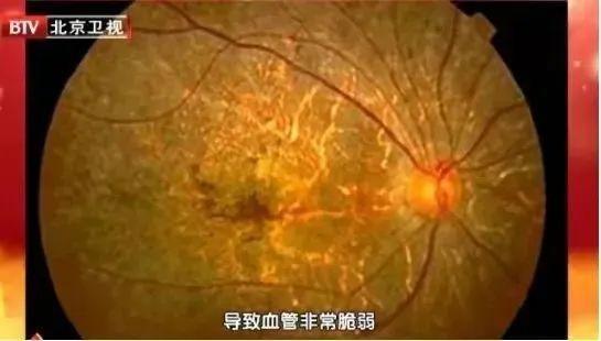 玩游戏的手机对眼睛的伤害_玩手机伤眼睛怎么恢复_眼睛玩手机会瞎吗