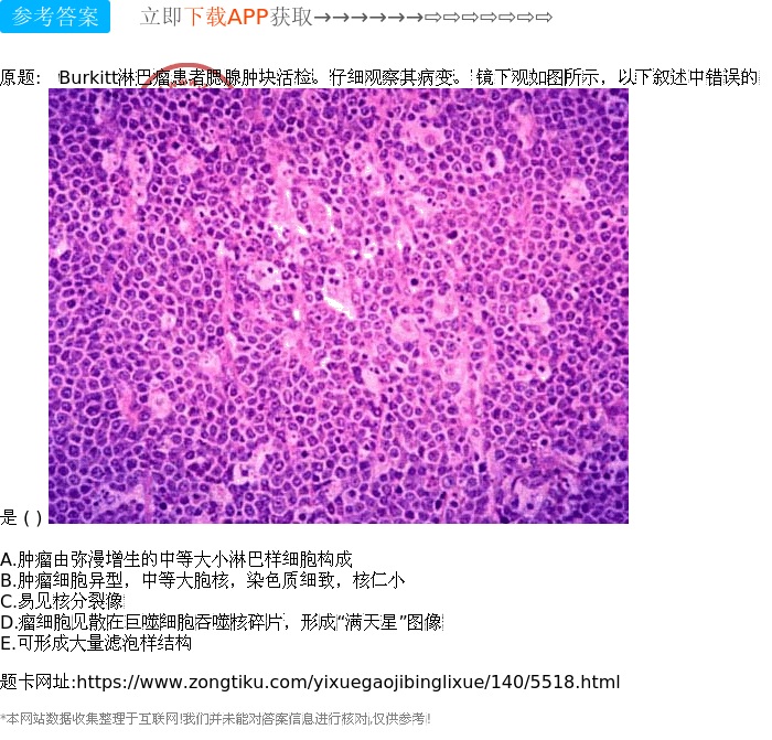 巨噬细胞缩写_巨噬细胞缩写怎么读_巨噬细胞的缩写